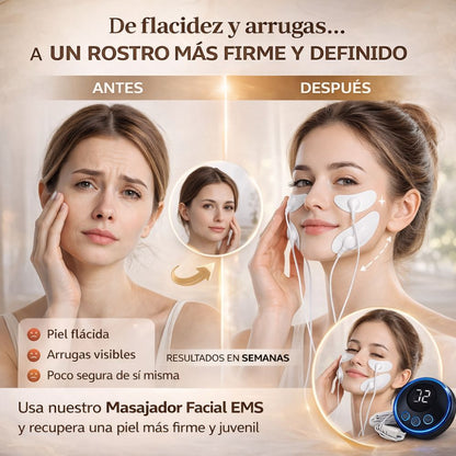 LuminaLift- Ayuda a tonificar tu piel todos los días en casa